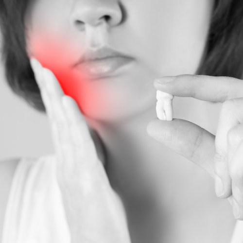 Dents de sagesse et leurs particularités