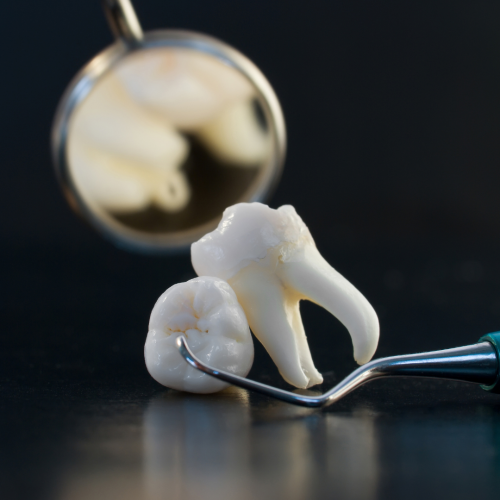 Suites opératoires après extraction