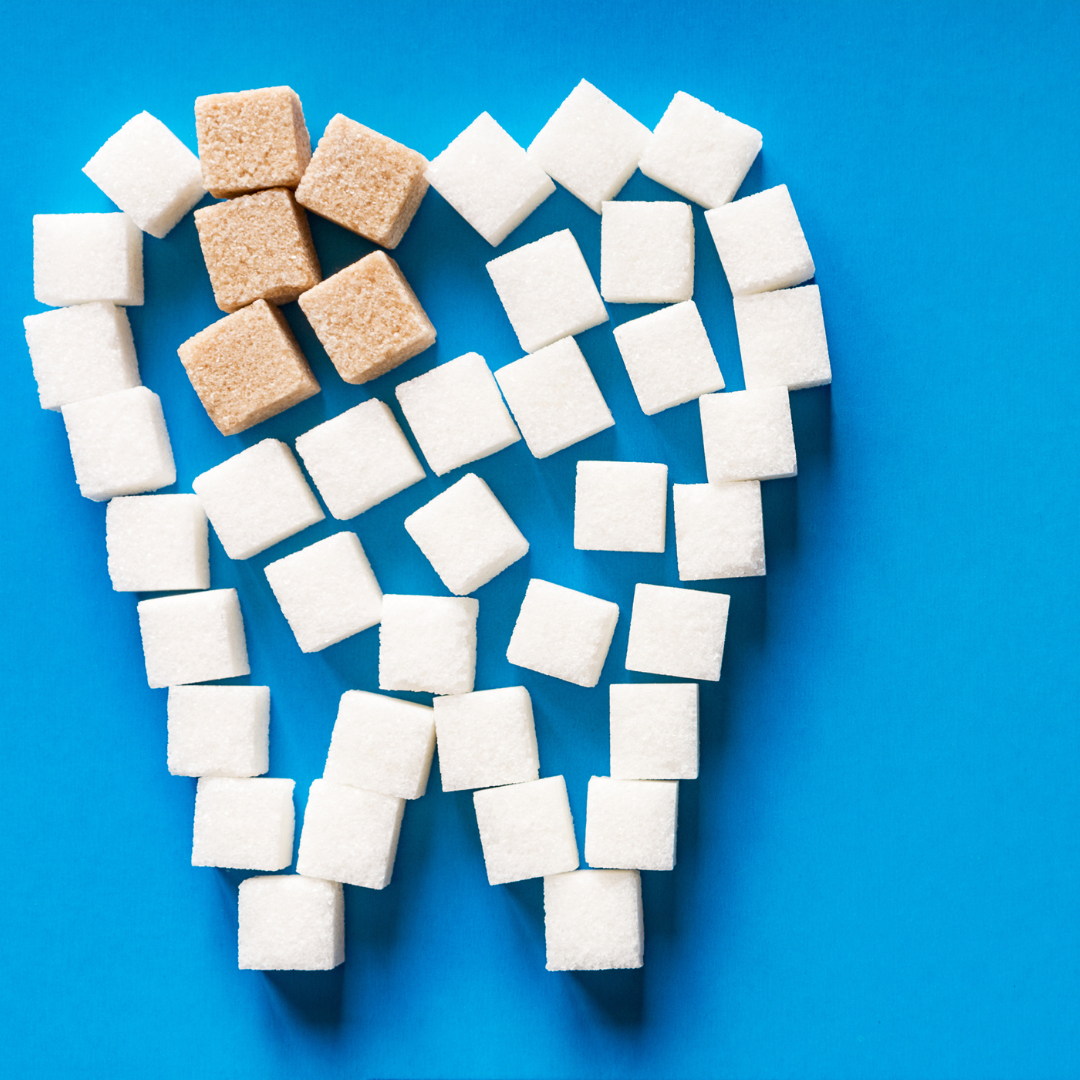 Prévention des caries : conseils pratiques