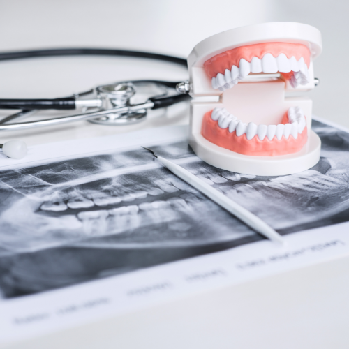 Radiographie dentaire au cabinet