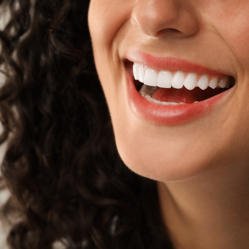 Innovations en dentisterie esthétique